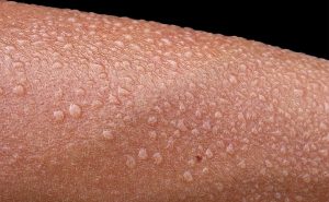 Lichaamstemperatuur en slaap